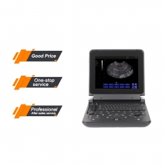 Профессиональный медицинский ультразвуковой сканер MY-A007C ноутбука BW