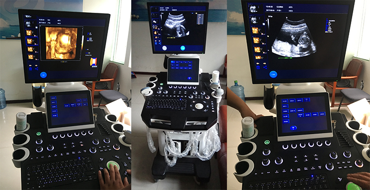 NEW Diagnostic Ultrasound System MY-A028D-N Medical Trolley 4D & CW Functions Color Doppler with Various Transducers