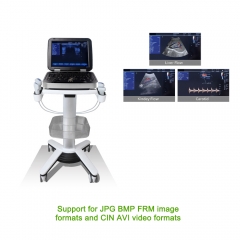 My - a024d couleur Doppler ordinateur portable hôpital équipement à ultrasons